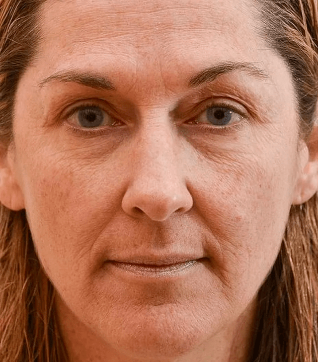 Лицето ми преди използването на крем Eudalie